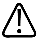 Diagram or illustration related to equipment protection and cable management.