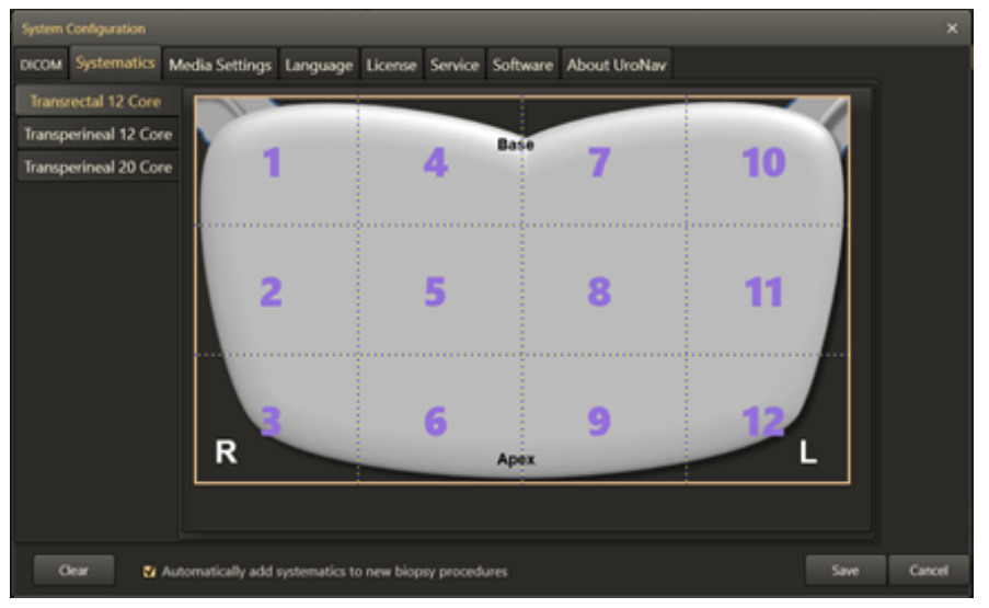 Image showing an example of transrectal systematic biopsy plan customization.