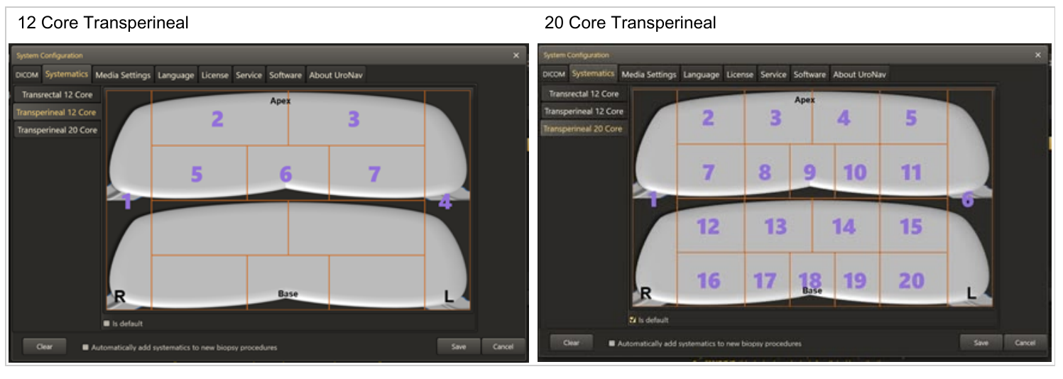 Image showing 12 Core and 20 Core Transperineal systematic target region configurations.
