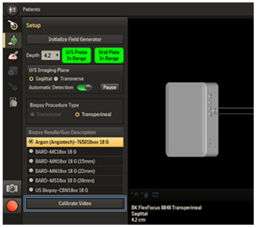 Screenshot of the ultrasound video calibration interface.