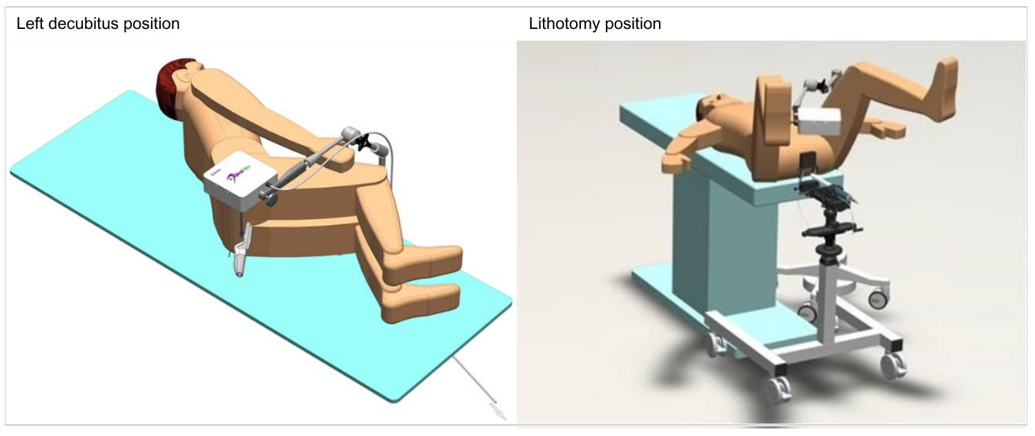 Photograph or diagram showing patient positioning for navigation, with field generator above the patient.