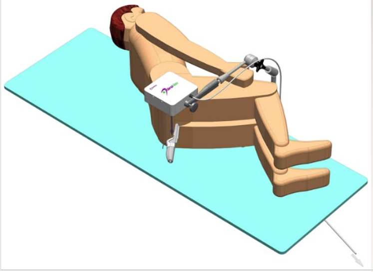 Photograph or diagram showing patient in left decubitus and lithotomy positions.
