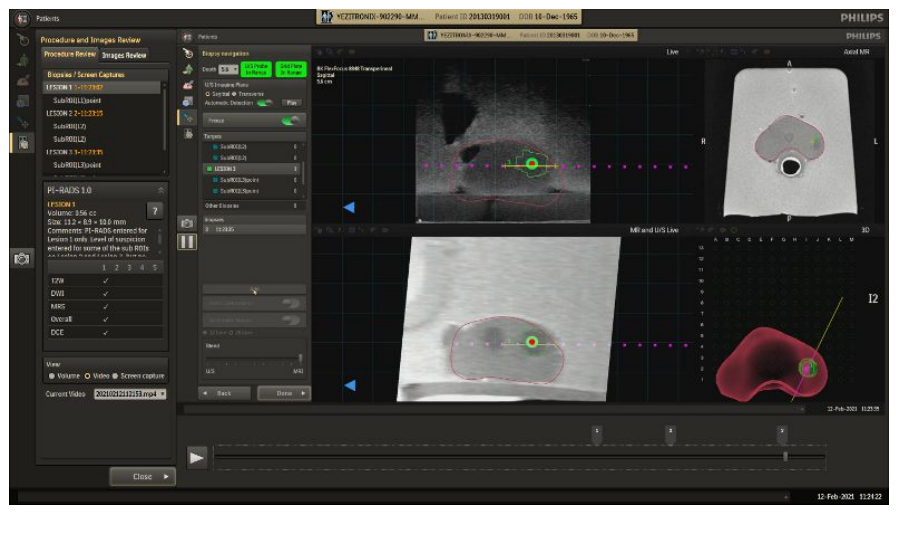 Screenshot of the video playback interface with bookmarks for recorded events.
