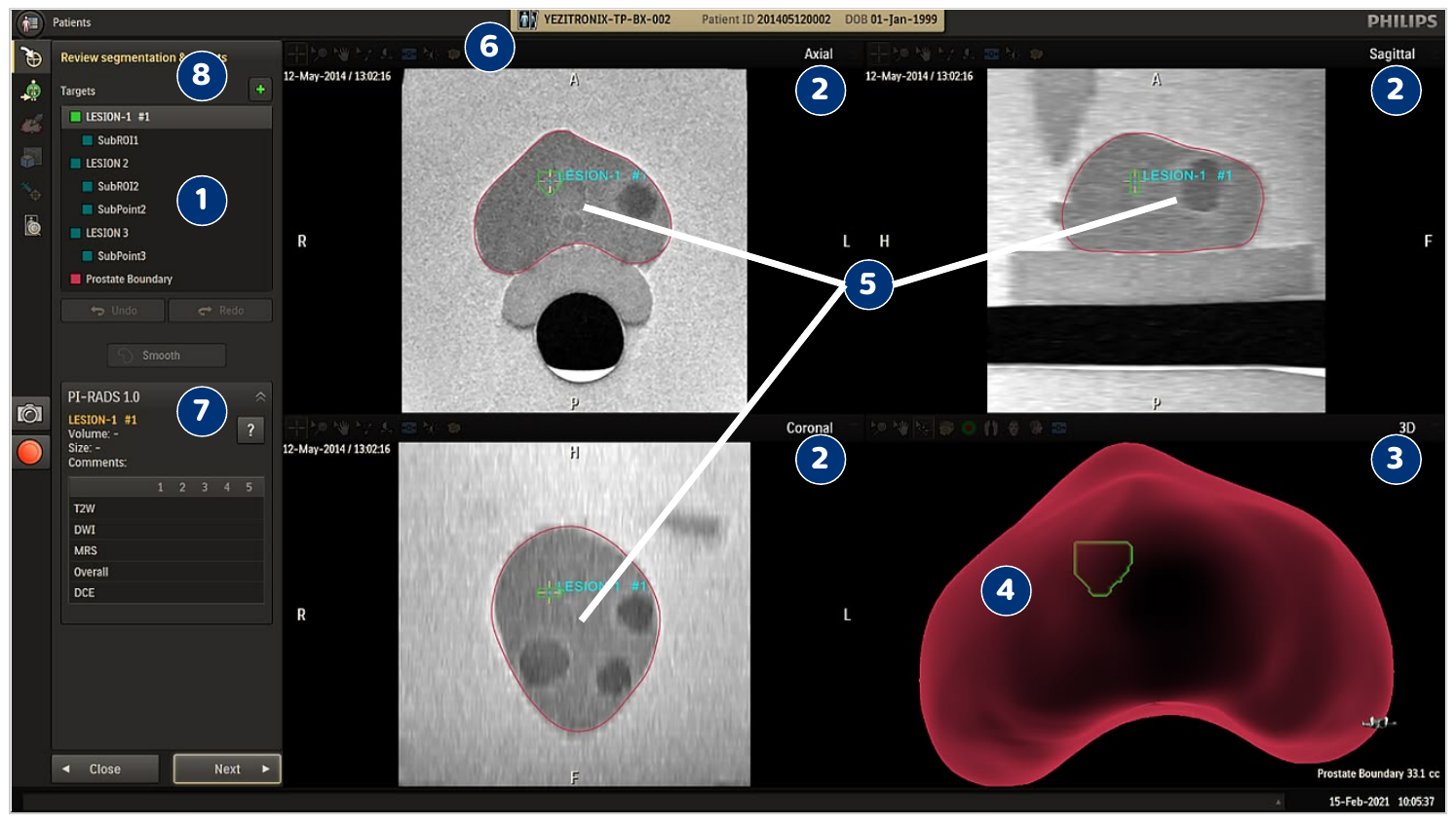 Screenshot of the Review Segmentation and Targets screen in the Biopsy workflow, showing MR segmentations, MPR viewports, and 3D mesh.