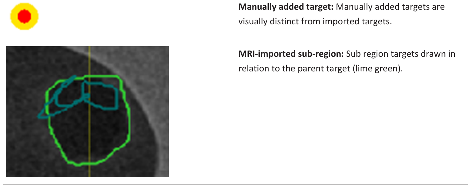 Screenshot of MRI-imported and manually added targets in the Biopsy workflow.