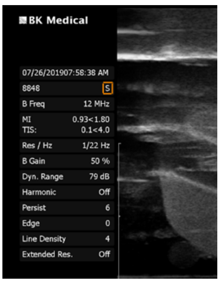 Screenshot of the Navigation tools initialization for EM Field in the Biopsy workflow.