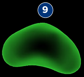Screenshot of the Segmentation interface in the Biopsy workflow, showing a specific tool or feature.