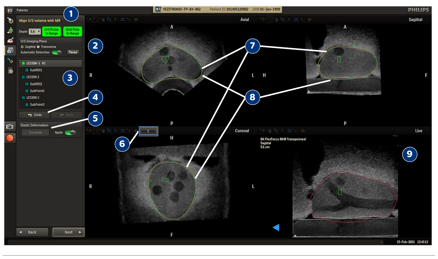 A large user interface screenshot or diagram with numbered callouts, illustrating the Biopsy workflow screen and its controls.