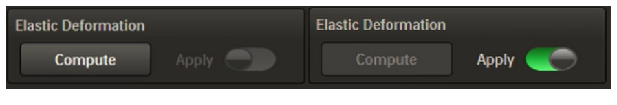 A user interface screenshot or diagram showing elastic deformation mapping between MR and ultrasound volumes.