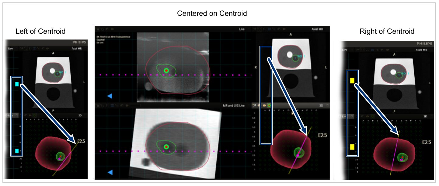 A large diagram or screenshot showing probe positions centered on, left of, and right of centroid.
