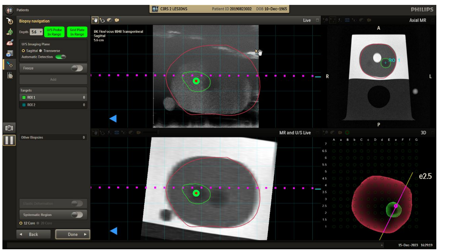 A large user interface screenshot or diagram showing the Procedure and Images Review screen.