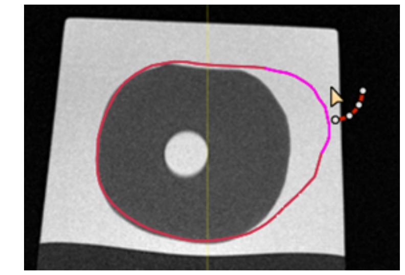 Screenshot showing the 3D Brush tool in use for ROI boundary adjustment.