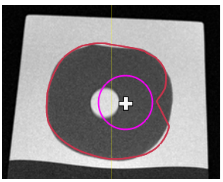 Screenshot showing the minus (-) sign for removing from ROI boundary with the 3D Brush tool.