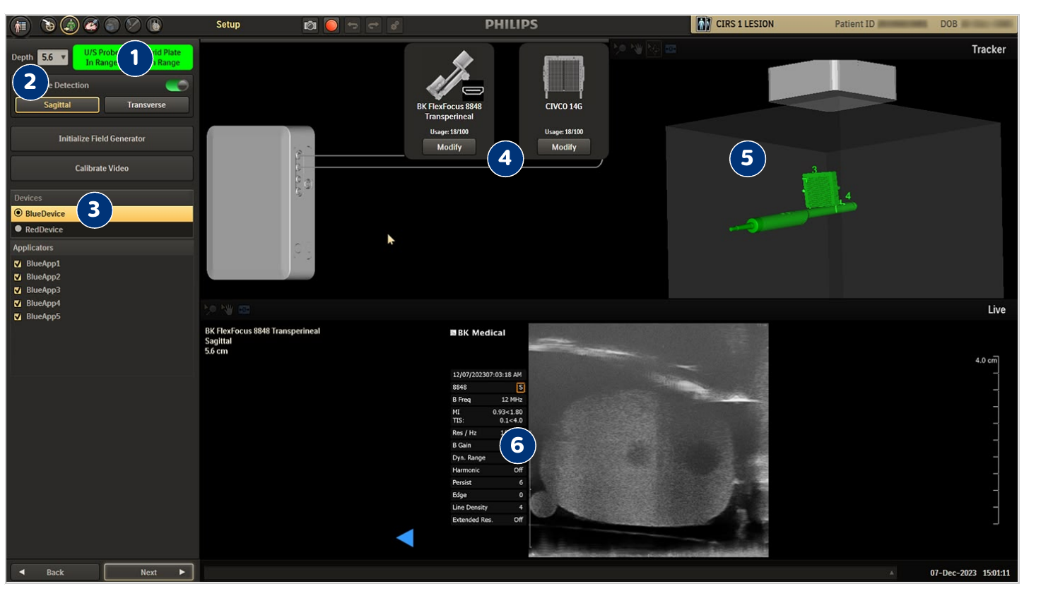 Screenshot of the Setup screen with EM Tracking tools, video connection tools, device list, sensor configuration, and live video feed.