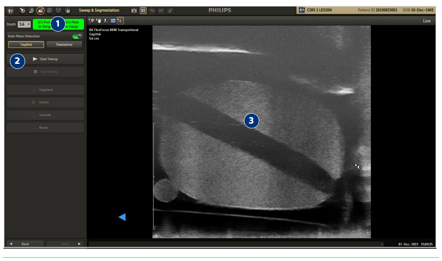 Screenshot of the Sweep and Segmentation screen showing controls and live ultrasound image.