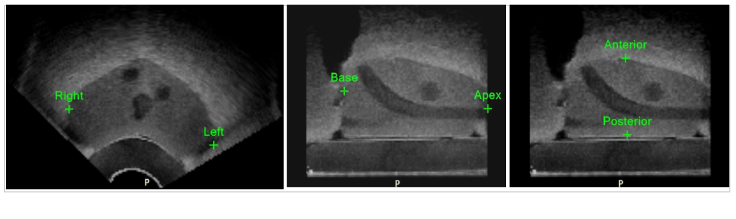 Screenshot showing the prostate ROI as a 3D model.