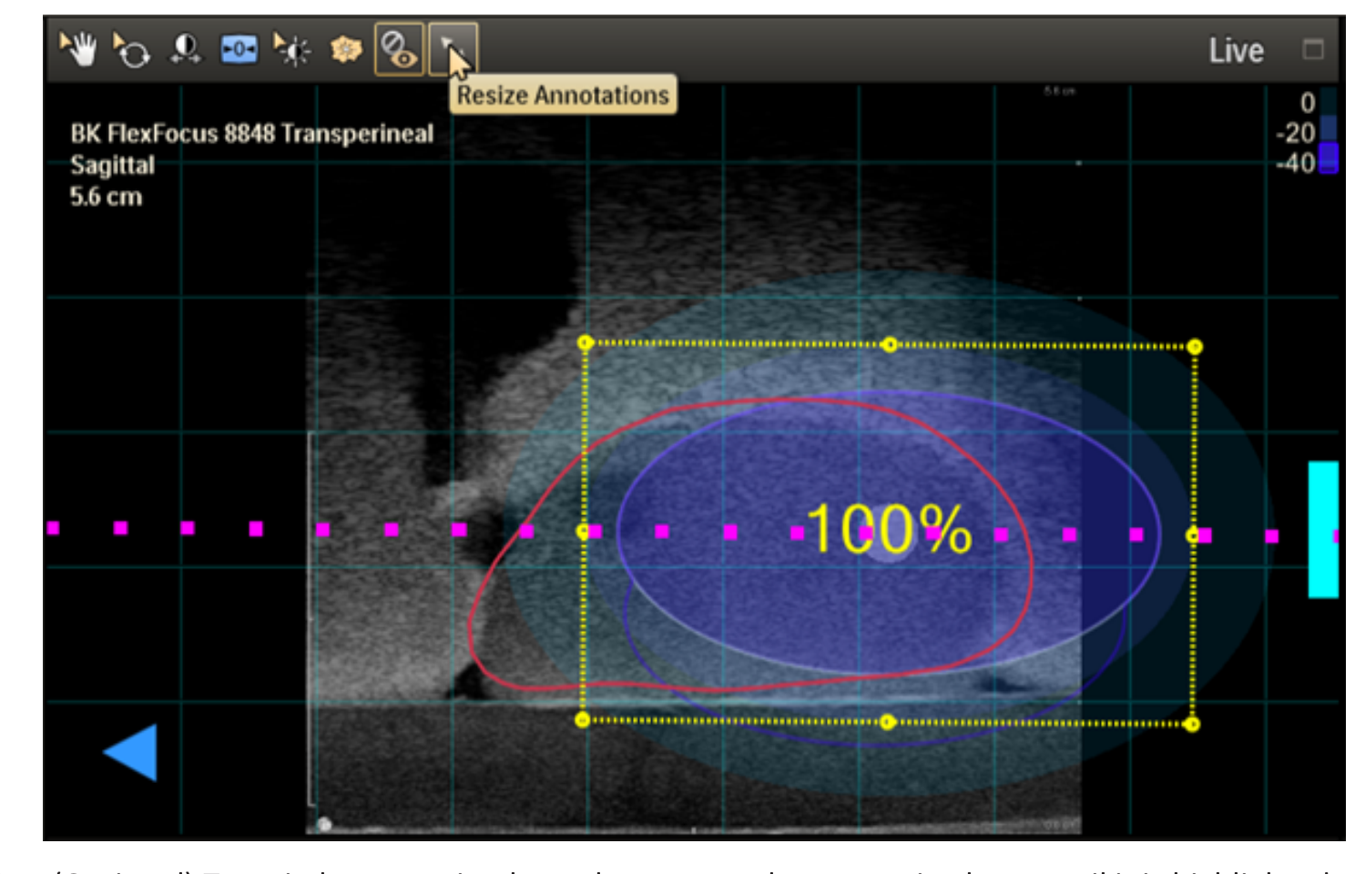 Screenshot showing the annotation list and bounding box for resizing.