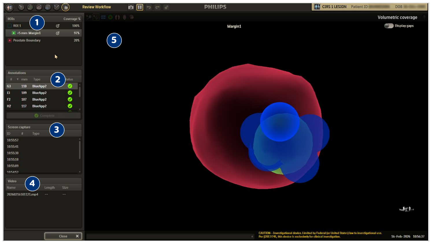 Screenshot or diagram of the Review Workflow screen with various workflow elements.