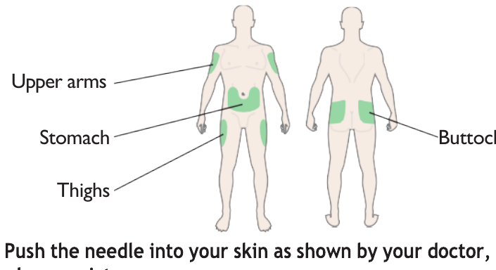 Diagram showing injection sites on the body for the pen.