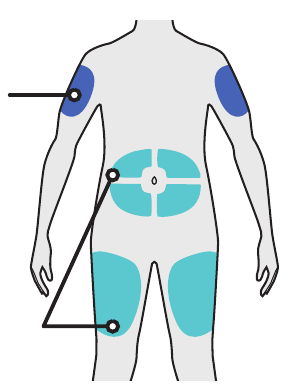 A diagram showing the correct way to hold the Dupixent pre-filled pen for injection.
