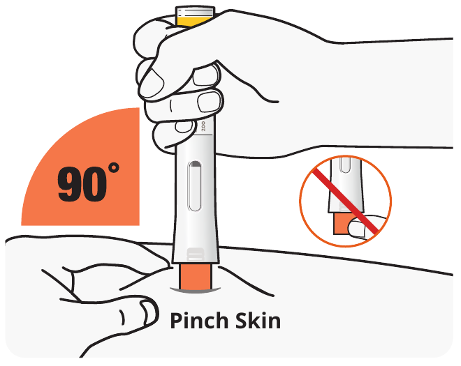 A diagram showing the correct way to pinch the skin for injection.