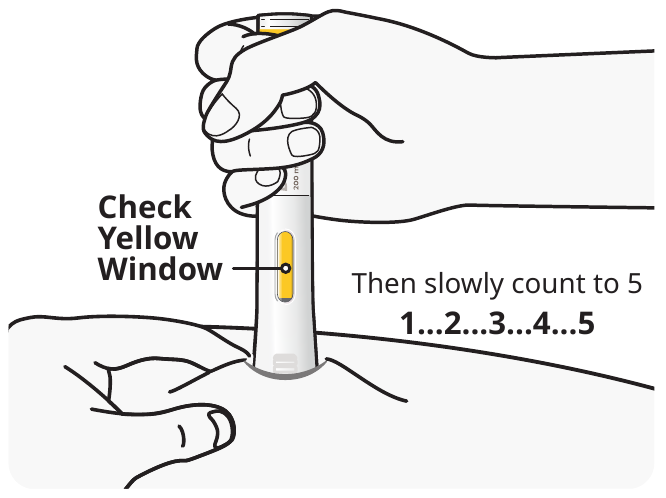 A diagram showing the window of the pen turning yellow after injection.